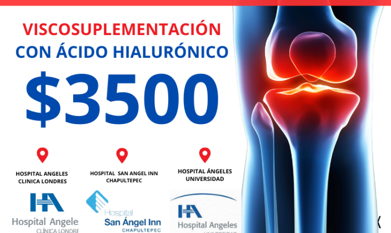 INFILTRACION DE RODILLA