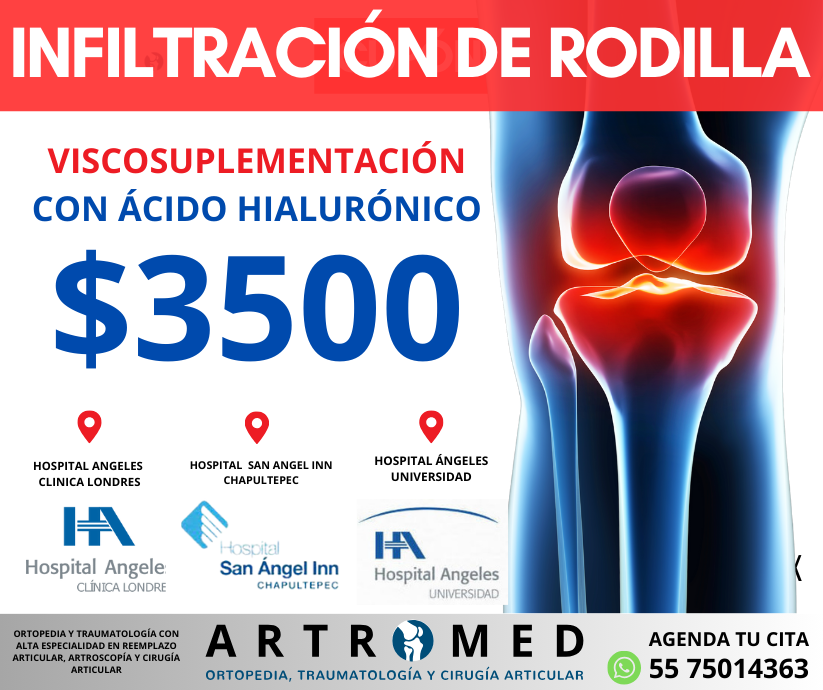 INFILTRACION DE RODILLA
